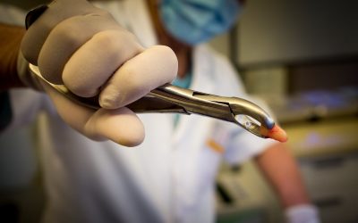 How a Dental Malpractice Lawyer Can Help You Get Justice After a Dental Injury